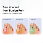 Bunion Corrector Splint Kit For Toe